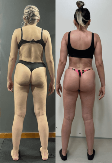 Antes e depois — Jessica